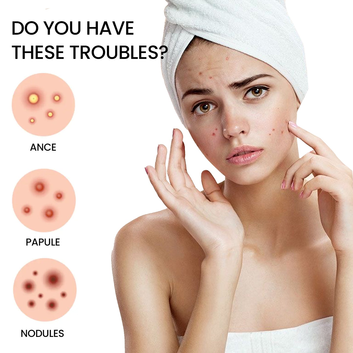 Acne Spots Blemishes Cover Acne Pimples