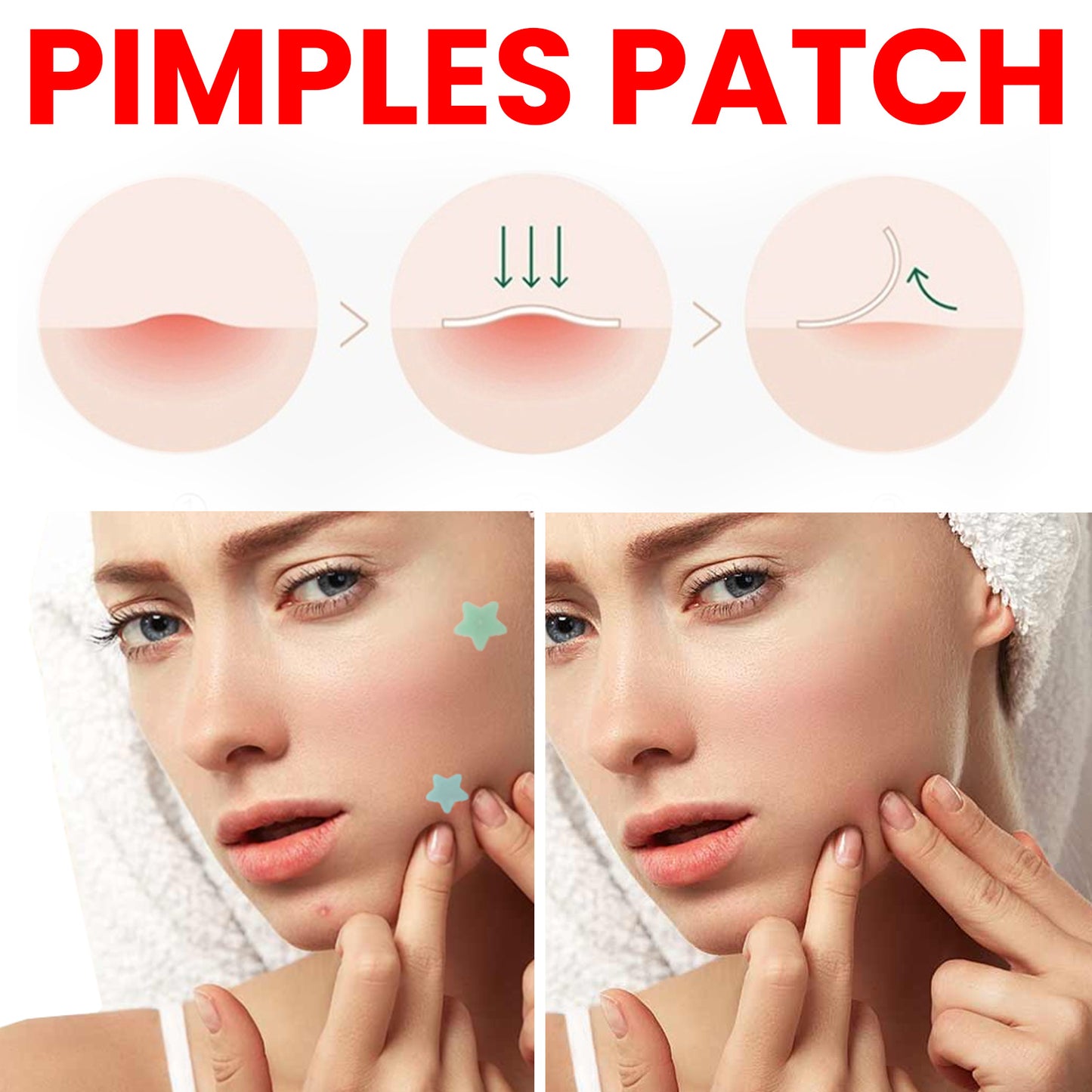 Acne Spots Blemishes Cover Acne Pimples