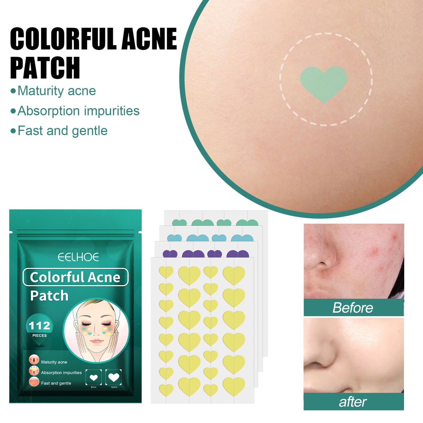 EELHOE Love Acne Patch Gentle Cleansing Acne Patch Fades Facial Acne Marks And Spots Facial Cleansing Care